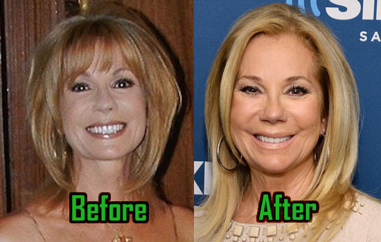 Did Kathie Lee Gifford have Plastic surgery? Instagram Before And After Photos