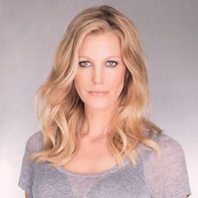 Anna Gunn Health Update: What Happened To Anna? Know More About The Apology Cast Current State Of Health
