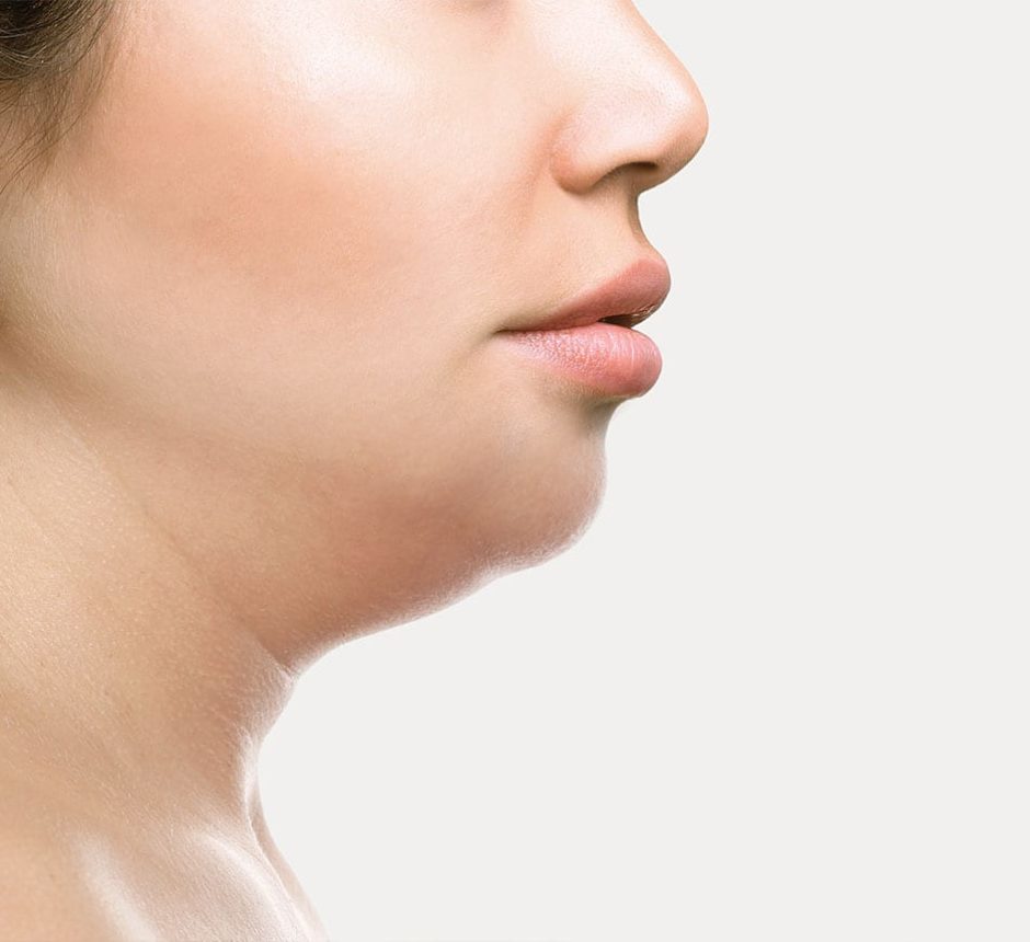 What Are The Exercises To Get Rid Of Double Chin?