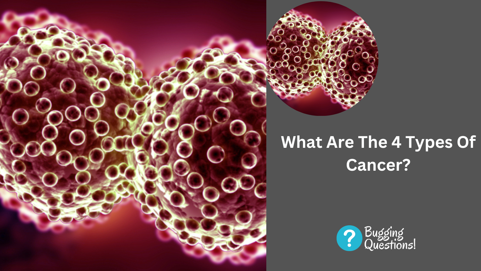 What Are The 4 Types Of Cancer?