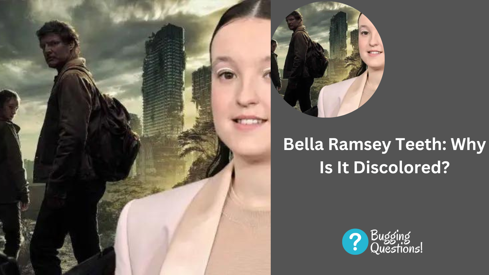 Bella Ramsey Teeth: Why Is It Discolored?
