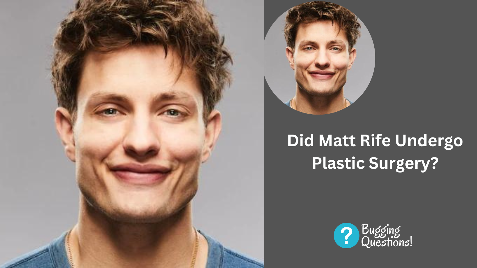 Did Matt Rife Undergo Plastic Surgery?