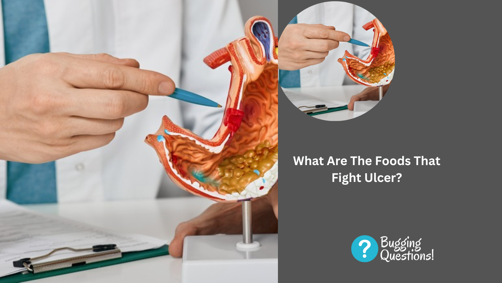 What Are The Foods That Fight Ulcer?
