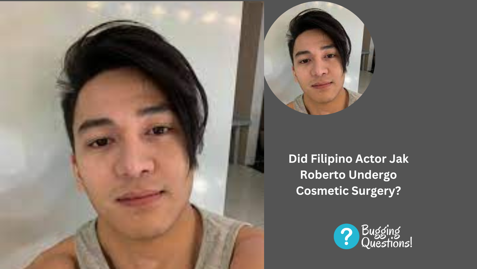 Did Filipino Actor Jak Roberto Undergo Cosmetic Surgery?
