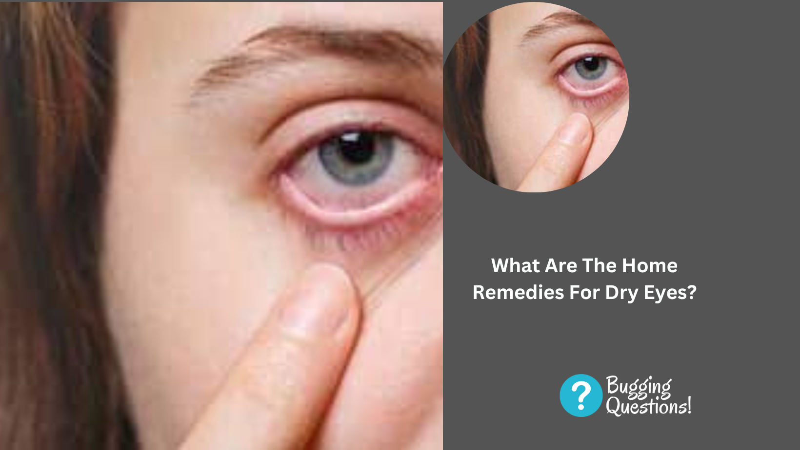 What Are The Home Remedies For Dry Eyes?