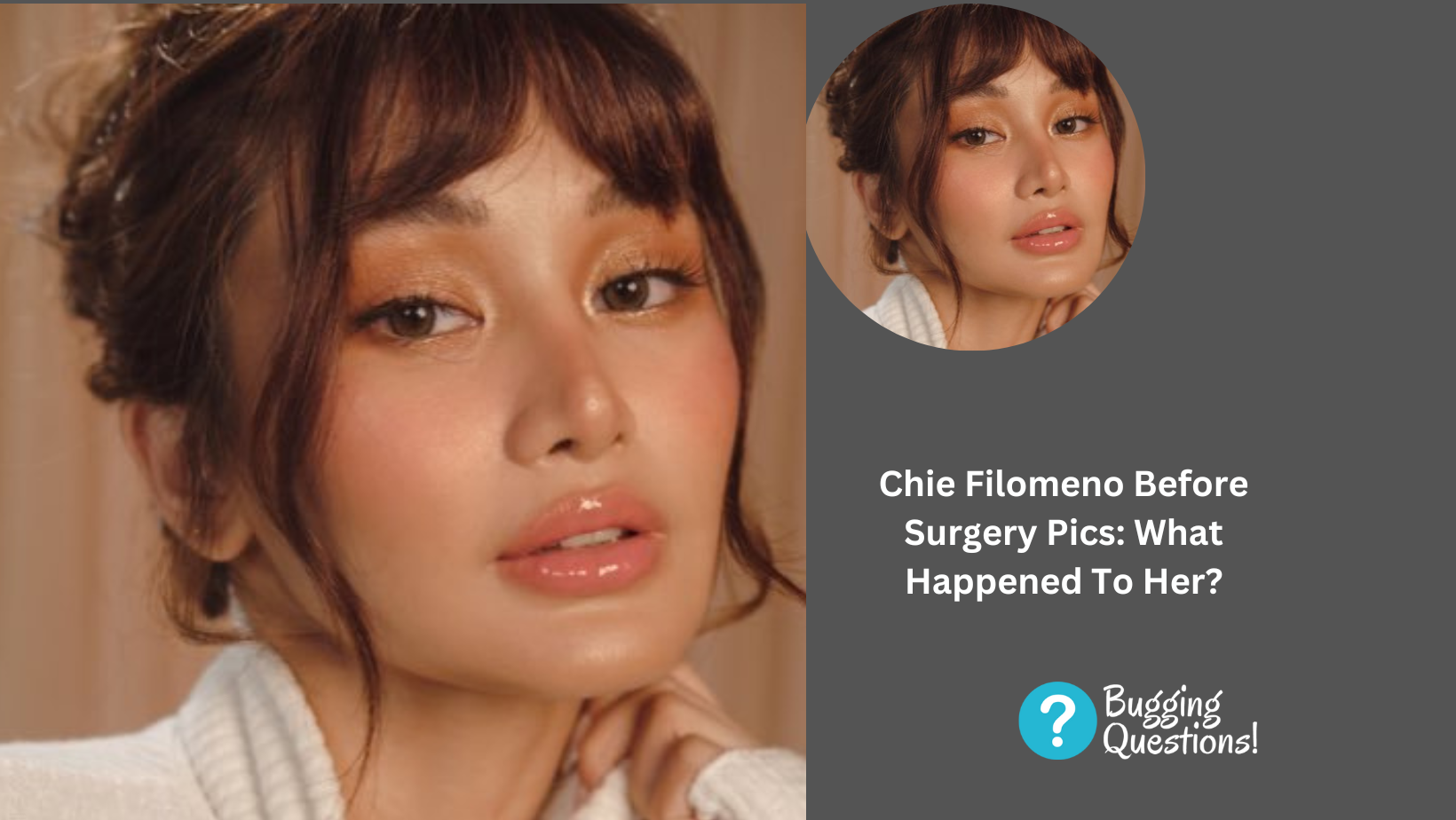 Chie Filomeno Before Surgery Pics: What Happened To Her?