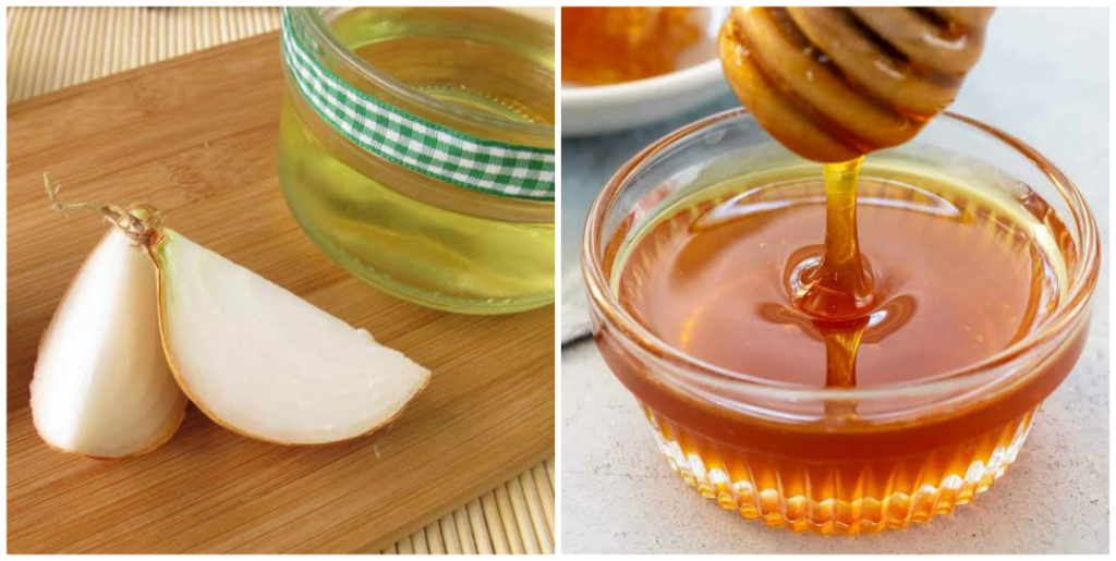 10 Amazing Health Benefits Of Onion And Honey