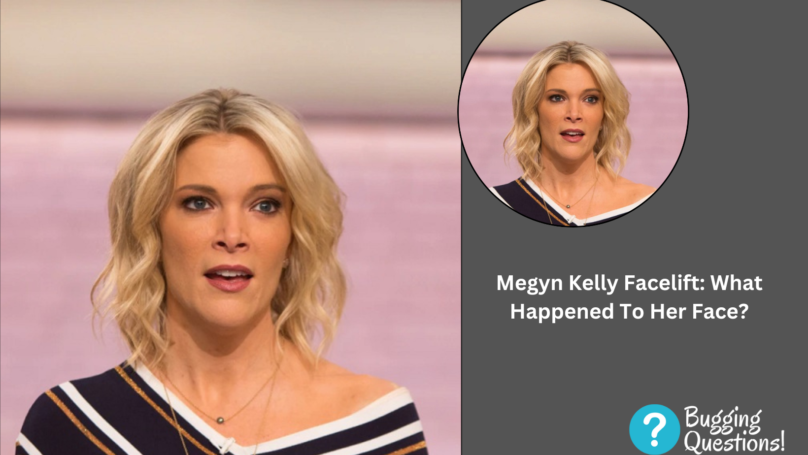 Megyn Kelly Facelift: What Happened To Her Face?