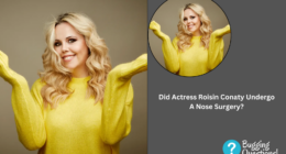 Did Actress Roisin Conaty Undergo A Nose Surgery?