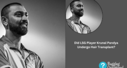 Did LSG Player Krunal Pandya Undergo Hair Transplant?